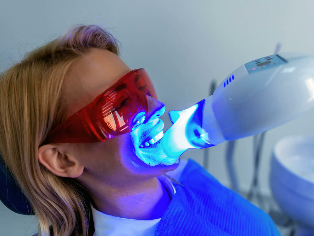 Patient receiving professional teeth whitening treatment