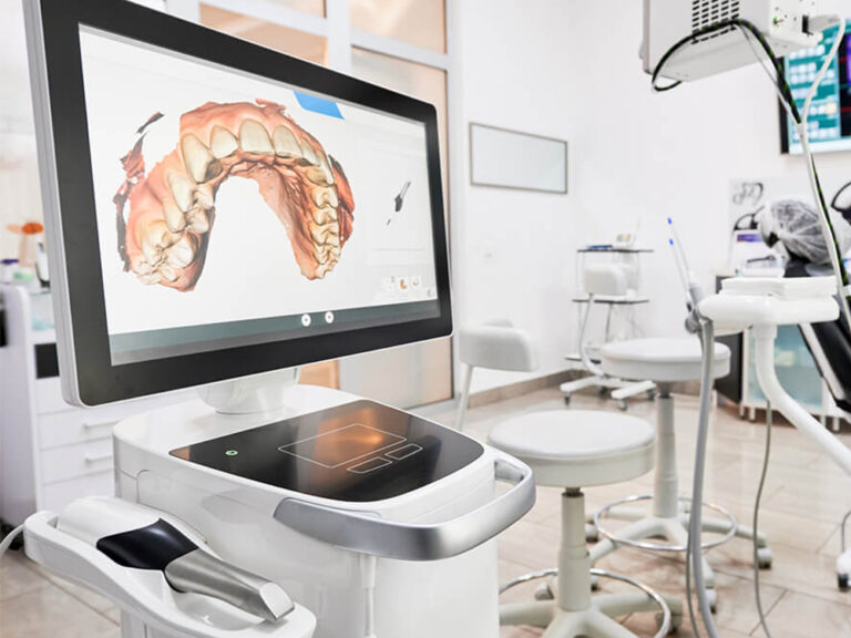 Image of a CEREC scanning machine, showing the digital impression of a patient's teeth.